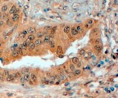 Immunohistochemistry-Paraffin: Semaphorin 3E Antibody [NB100-55417]