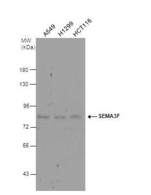 Western Blot: Semaphorin 3F Antibody [NBP2-15113]