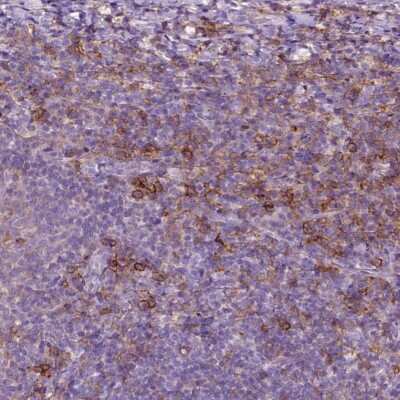 Immunohistochemistry-Paraffin: Semaphorin 4A Antibody [NBP2-49588]