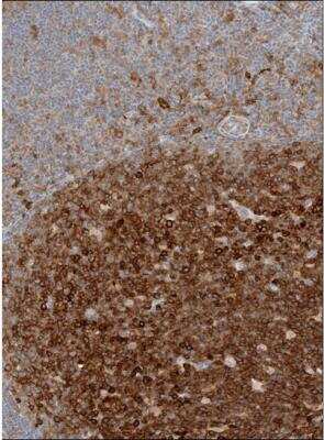 Immunohistochemistry-Paraffin: Semaphorin 4A Antibody [NBP2-49588]