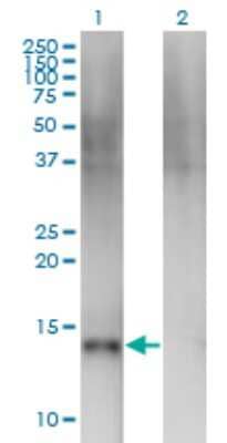 Western Blot: Semaphorin 4B Antibody (4B2) [H00010509-M03]