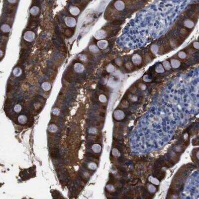 Immunohistochemistry-Paraffin: Semaphorin 4B Antibody [NBP1-81377]