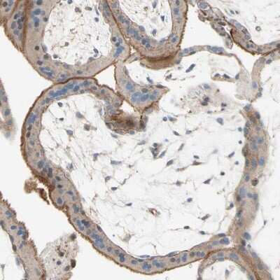 Immunohistochemistry-Paraffin: Semaphorin 4C Antibody [NBP1-80769]