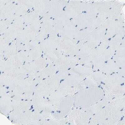 Immunohistochemistry-Paraffin: Semaphorin 4C Antibody [NBP1-80769]