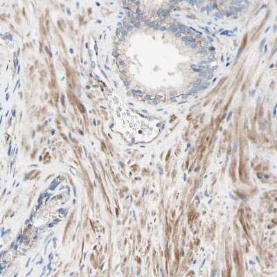 Immunohistochemistry-Paraffin: Semaphorin 4C Antibody [NBP1-80769]