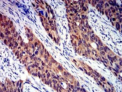 Immunohistochemistry: Semaphorin 4D/CD100 Antibody (5H6E3) - BSA Free [NBP2-61663]