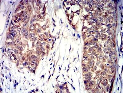 Immunohistochemistry: Semaphorin 4D/CD100 Antibody (5H6E3) - BSA Free [NBP2-61663]