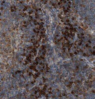 Immunohistochemistry-Paraffin: Semaphorin 4D/CD100 Antibody [NBP1-86705]