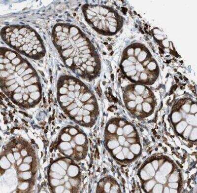 Immunohistochemistry-Paraffin: Semaphorin 4D/CD100 Antibody [NBP1-86705]
