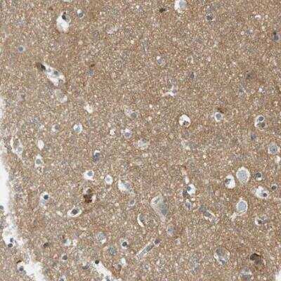 Immunohistochemistry-Paraffin: Semaphorin 4D/CD100 Antibody [NBP1-86705]
