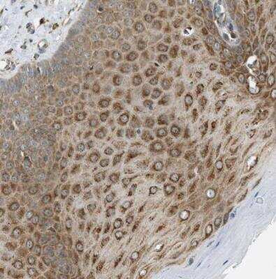 Immunohistochemistry-Paraffin: Semaphorin 4D/CD100 Antibody [NBP1-86705]