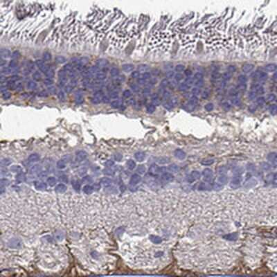 Immunohistochemistry-Paraffin: Semaphorin 4F Antibody [NBP2-68815]