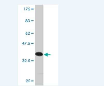 Western Blot: Semaphorin 4G Antibody (3F2) [H00057715-M01]