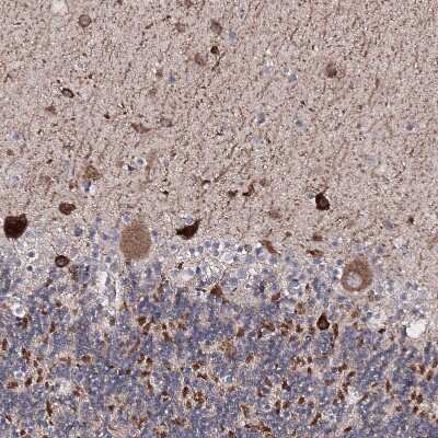 Immunohistochemistry-Paraffin: Semaphorin 4G Antibody [NBP1-82171]