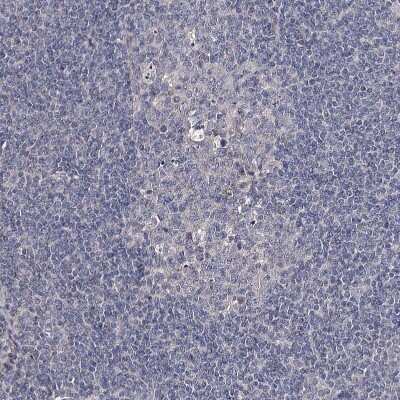 Immunohistochemistry-Paraffin: Semaphorin 4G Antibody [NBP1-82171]