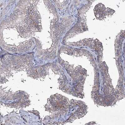 Immunohistochemistry-Paraffin: Semaphorin 4G Antibody [NBP1-82171]