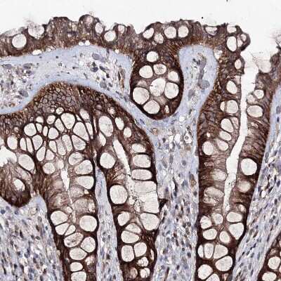 Immunohistochemistry-Paraffin: Semaphorin 4G Antibody [NBP1-82171]