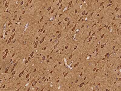 Immunohistochemistry-Paraffin: Semaphorin 4G Antibody [NBP2-97839]
