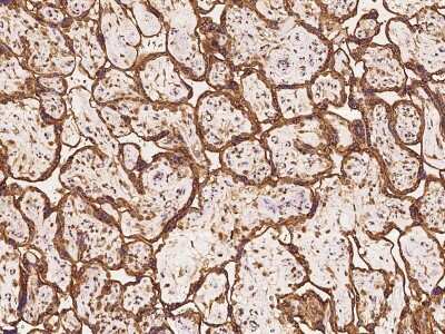 Immunohistochemistry-Paraffin: Semaphorin 4G Antibody [NBP2-97839]