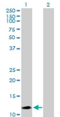 Western Blot: Semaphorin 4G Antibody [H00057715-B02P]