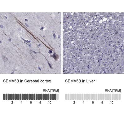 Immunohistochemistry-Paraffin: Semaphorin 5B Antibody [NBP2-56604]