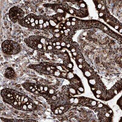 Immunohistochemistry-Paraffin: Semaphorin 6A Antibody [NBP1-83155]