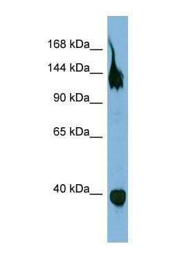 Western Blot: Semaphorin 6A Antibody [NBP1-69281]