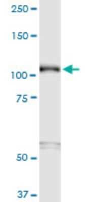 Western Blot: Semaphorin 6B Antibody (2H7) [H00010501-M01]