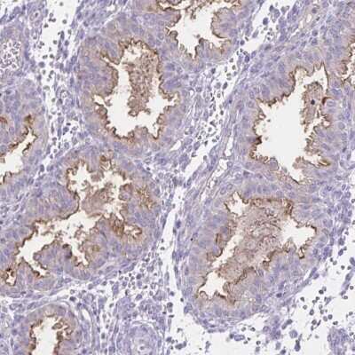 Immunohistochemistry: Semaphorin 6B Antibody [NBP2-37970]