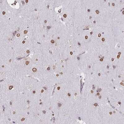 Immunohistochemistry-Paraffin: Semaphorin 6B Antibody [NBP2-37950]