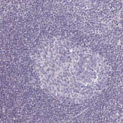 Immunohistochemistry-Paraffin: Semaphorin 6B Antibody [NBP2-37950]