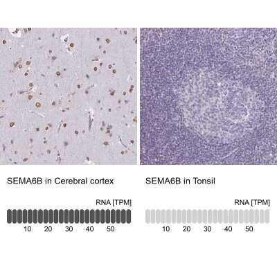 Immunohistochemistry-Paraffin: Semaphorin 6B Antibody [NBP2-37950]