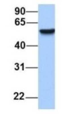 Western Blot: Semaphorin 6D Antibody [NBP1-69272]