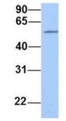 Western Blot: Semaphorin 6D Antibody [NBP1-69272]