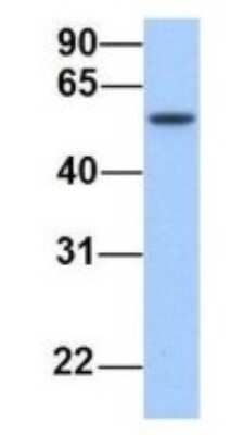 Western Blot: Semaphorin 6D Antibody [NBP1-69272]