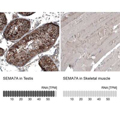 Immunohistochemistry-Paraffin: Semaphorin 7A Antibody [NBP1-86555]