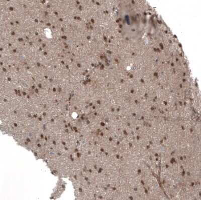 Immunohistochemistry-Paraffin: Semaphorin 7A Antibody [NBP1-86555]