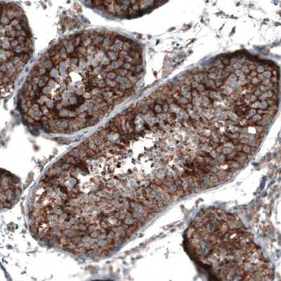 Immunohistochemistry-Paraffin: Semaphorin 7A Antibody [NBP1-86555]