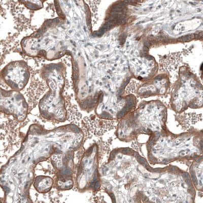 Immunohistochemistry-Paraffin: Semaphorin 7A Antibody [NBP1-86555]