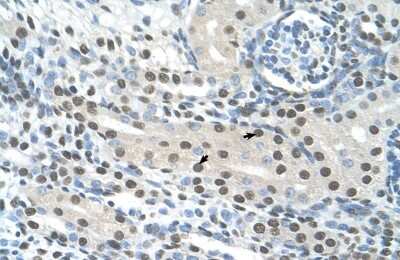 Immunohistochemistry: Semenogelin I Antibody [NBP1-58013]