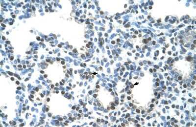 Immunohistochemistry: Semenogelin I Antibody [NBP1-58013]