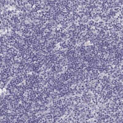 Immunohistochemistry-Paraffin: Semenogelin I Antibody [NBP1-85425]