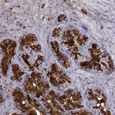 Immunohistochemistry-Paraffin: Semenogelin I Antibody [NBP1-85425]