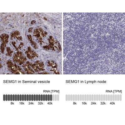 Immunohistochemistry-Paraffin: Semenogelin I Antibody [NBP1-85425]