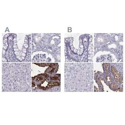 Immunohistochemistry-Paraffin: Semenogelin I Antibody [NBP1-85425]
