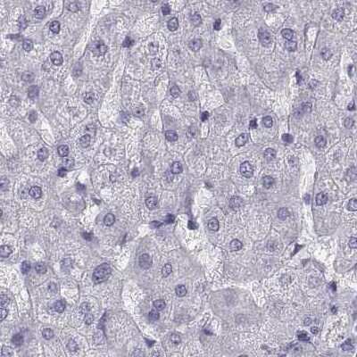 Immunohistochemistry-Paraffin: Semenogelin I Antibody [NBP1-85425]