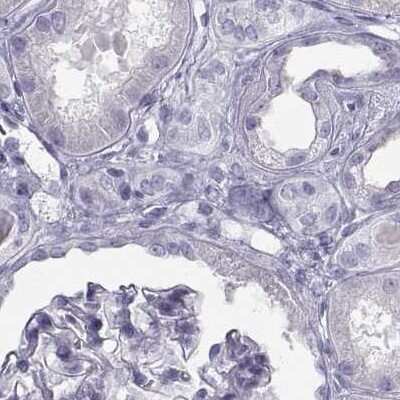 Immunohistochemistry-Paraffin: Semenogelin I Antibody [NBP1-85425]