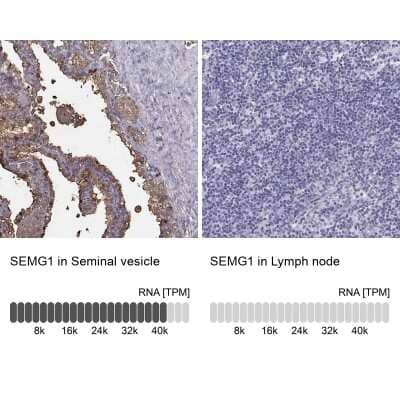 Immunohistochemistry-Paraffin: Semenogelin I Antibody [NBP2-62646]
