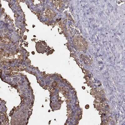 Immunohistochemistry-Paraffin: Semenogelin I Antibody [NBP2-62646]