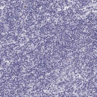 Immunohistochemistry-Paraffin: Semenogelin I Antibody [NBP2-62646]